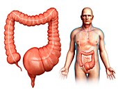 Mega colon,illustration