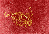 DNA and E. coli RNA polymerase reaction