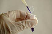 DNA sample in test tube