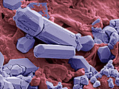 Natural statin crystals in red yeast rice