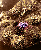 HeLa cells with Adenovirus