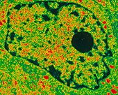 Coloured TEM of typical cell nucleus