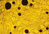 TEM of dark-staining peroxisomes