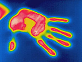 Thermogram of hands thermal shadow