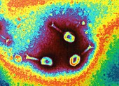 TEM of herpes simplex virus particles