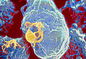 False-colour SEM of budding AIDS viruses