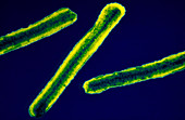 Coloured TEM of Marburg viruses