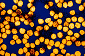 Yellow fever virus particles,TEM