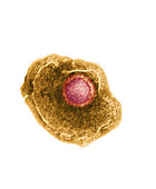 Varicella (Chickenpox) virus