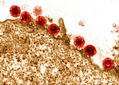 Herpesvirus 6 on an infected lymphocyte