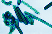 Marburg virus particles,TEM