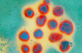 False-colour TEM of influenza virus (Hong Kong)