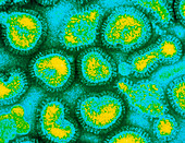 False-colour TEM of a cluster of influenza viruses