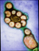 Coloured TEM of Hong Kong influenza viruses