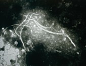 TEM of fibrils in mad cow disease