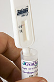 Oral HIV Test