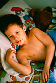 4 year old boy in bed with chicken pox