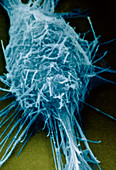 Neuroblastoma cancer cell,SEM