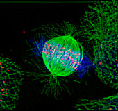 Human cancer cell in metaphase