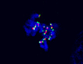Human cancer cell in prometaphase