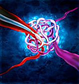 Illustration of brain AVM therapy