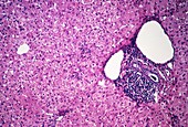 LM of a liver with chronic persistent hepatitis