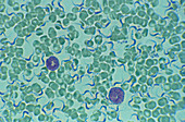 LM of sleeping sickness trypanosomes in blood