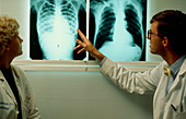 Doctors viewing X-ray of patient with tuberculosis