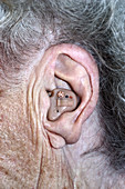 Hearing Aid