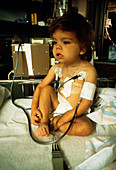 Diabetic child undergoing renal dialysis