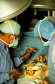 Surgeons performing kidney transplant operation