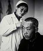 Acupuncture in China