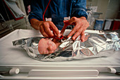 Premature baby in incubator with aluminium blanket