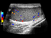 Testicular ultrasound