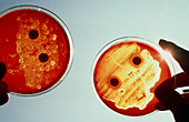 Bacteriol testing for streptoccoccus