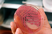 Petri dish with pneumonia bacteria