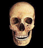 Female Skull