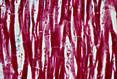 LM of normal human cardiac muscle fibres