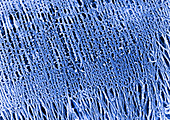 Interdigitation of actin and myosin filaments