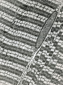 TEM showing two striated muscle cells