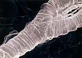 SEM of exterior of human branching arteriole