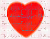 Heart and EKG Reading
