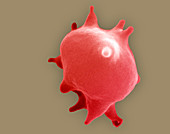 Red blood cell in hypertonic solution