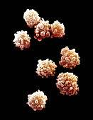 Lymphocytes Undergoing Apoptosis