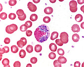 Moderately advanced eosinophil