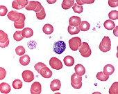 Small lymphocyte