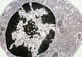 TEM of plasma cell of guinea pig bone marrow
