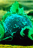 False-colour SEM of a macrophage on lung tissue