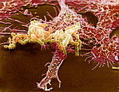 Macrophage ingesting pseudomonas