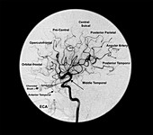 Branches of the Middle Cerebral Artery
